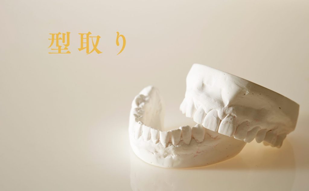 型取りという文字と歯の石膏模型の写真